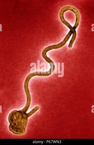 Transmission electron Micrograph of the Ebola Virus Hemorrhagic Fever RNA Virus Stock Photo