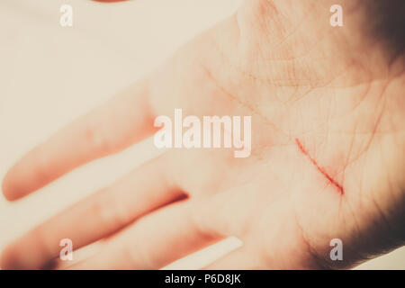 Woman palm with a red fresh cut scratch on a destiny line. close up Stock Photo