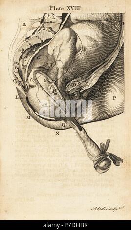 Foetus head brought lower down in the birth canal with forceps. Copperplate engraving by Andrew Bell after an illustration by Jan van Rymsdyk from William Smellie's A Set of Anatomical Tables, Charles Elliot, Edinburgh, 1780. Stock Photo