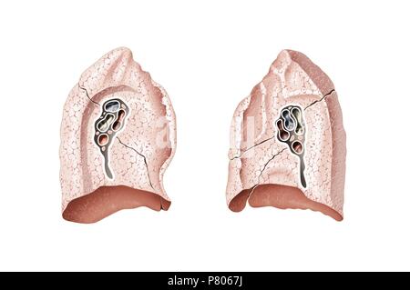 download hilum of lung for free