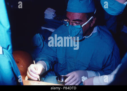 Der südafrikanische Herzchirurg Professor Christiaan Barnard bei einer Operation in Kapstadt, Südafrika 1970er Jahre. South African cardiac surgeon Christiaan Barnard during a surgery at Cape Town, South Africa 1970s. Stock Photo