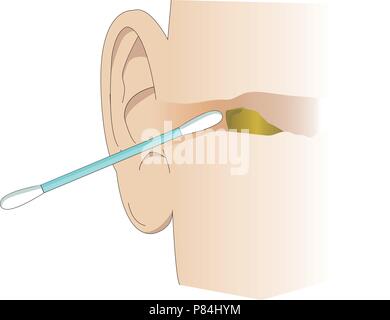 Smiling cute cotton bud cleaning kids ear Vector Image