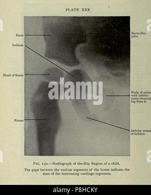 vintage radio graphic x-ray plate annotated Stock Photo - Alamy