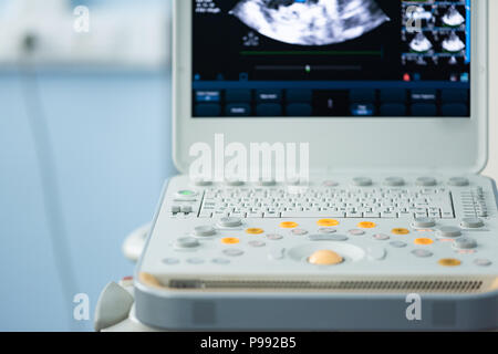 Orange and gray buttons of the keyboard of the device for ultrasound examination on the background of the defocused screen with the image of the heart Stock Photo