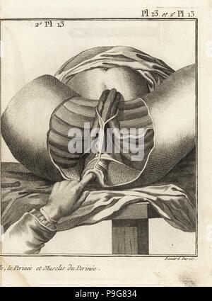 Foubert's surgical operation to remove a bladder stone. The muscles of the perineum in a subject of 16 or 17 years. Copperplate engraving by Robert Benard from Denis Diderot's Encyclopedia, Pellet, Geneva, 1779. Stock Photo