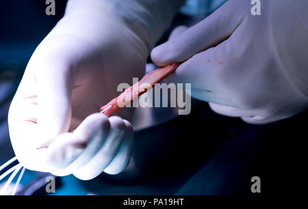 Munich, Germany. 19th July, 2018. A doctor preparing a replacement cruciate ligament out of one of the patient's own tendons during a knee operation in the Orthopedic Surgical Ward Munich (OCM). The patient was later outfitted with the replacement cruciate ligament. Credit: Sven Hoppe/dpa/Alamy Live News