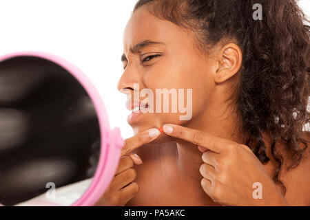 Woman with pimple on face Stock Photo - Alamy
