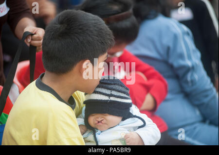 Family of cleft lip, brothers. Children with chullo waiting embraced. Stock Photo
