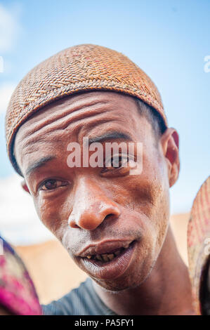 MADAGASCAR - JUNE 30, 2011: Portrait of an unidentified surprised man in Madagascar, June 30, 2011. People of Madagascar suffer of poverty due to the  Stock Photo