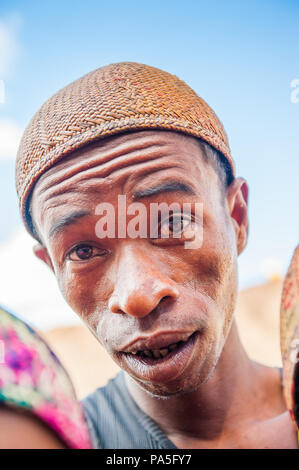 MADAGASCAR - JUNE 30, 2011: Portrait of an unidentified surprised man in Madagascar, June 30, 2011. People of Madagascar suffer of poverty due to the  Stock Photo