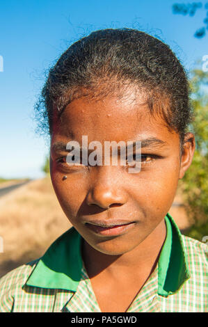 MADAGASCAR - JULY 3, 2011: Portrait of an unidentified girl in Madagascar, July 3, 2011. Children of Madagascar suffer of poverty due to the unstable  Stock Photo