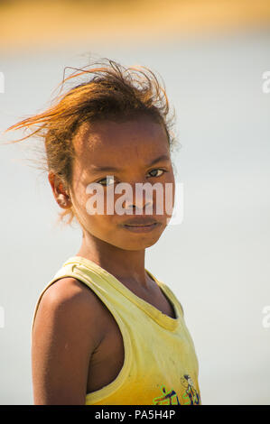 MADAGASCAR - JULY 5, 2011: Portrait of an unidentified beautiful girl in Madagascar, July 5, 2011. Children of Madagascar suffer of poverty due to the Stock Photo