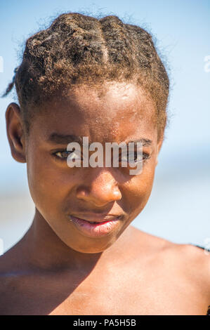 MADAGASCAR - JULY 5, 2011: Portrait of an unidentified girl in Madagascar, July 5, 2011. Children of Madagascar suffer of poverty due to the unstable  Stock Photo