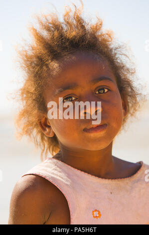 MADAGASCAR - JULY 5, 2011: Portrait of an unidentified girl in Madagascar, July 5, 2011. Children of Madagascar suffer of poverty due to the unstable  Stock Photo