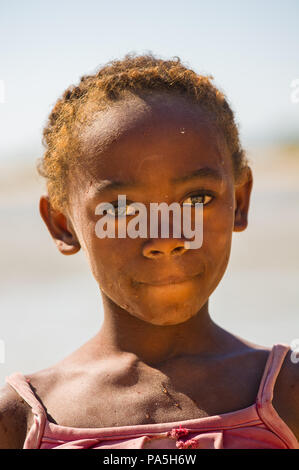 MADAGASCAR - JULY 5, 2011: Portrait of an unidentified girl in Madagascar, July 5, 2011. Children of Madagascar suffer of poverty due to the unstable  Stock Photo