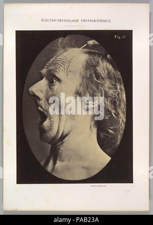 Figure 57: Astonishment, stupefaction, amazement. Artist: Guillaume-Benjamin-Amand Duchenne de Boulogne (French, 1806-1875); Adrien Tournachon (French, 1825-1903). Dimensions: Image (Oval): 28.3 × 20.3 cm (11 1/8 × 8 in.)  Sheet: 29.9 × 22.7 cm (11 3/4 in., 22.7 kg)  Mount: 40.2 × 28.4 cm (15 13/16 × 11 3/16 in.). Date: 1854-56, printed 1862. Museum: Metropolitan Museum of Art, New York, USA. Stock Photo