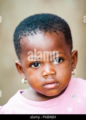 ACCRA, GHANA - MARCH 4, 2012: Unidentified Ghanaian beautiful girl with earings in the street in Ghana. Children of Ghana suffer of poverty due to the Stock Photo