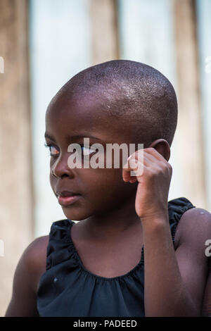 LIBREVILLE, GABON - MAR 6, 2013: Portrait of an Unidentified Gabonese serious little girl without hair in Gabon, Mar 6, 2013. People of Gabon suffer o Stock Photo