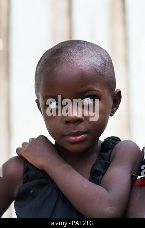 LIBREVILLE, GABON - MAR 6, 2013: Portrait of an Unidentified Gabonese serious little girl without hair in Gabon, Mar 6, 2013. People of Gabon suffer o Stock Photo