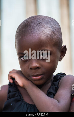 LIBREVILLE, GABON - MAR 6, 2013: Portrait of an Unidentified Gabonese serious little girl without hair in Gabon, Mar 6, 2013. People of Gabon suffer o Stock Photo