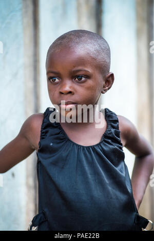 LIBREVILLE, GABON - MAR 6, 2013: Portrait of an Unidentified Gabonese beautiful little girl without hair in Gabon, Mar 6, 2013. People of Gabon suffer Stock Photo