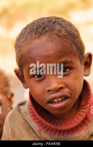 MADAGASCAR - JUNE 30, 2011: Portrait of an unidentified boy iwatching the camera in Madagascar, June 30, 2011. Children of Madagascar suffer of povert Stock Photo