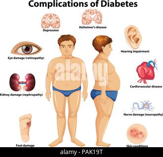 Complications of Diabetes concept illustration Stock Vector