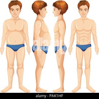 Male body obese and healthy  illustration Stock Vector