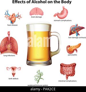 Effects of Alcohol on the Body illustration Stock Vector Image & Art ...