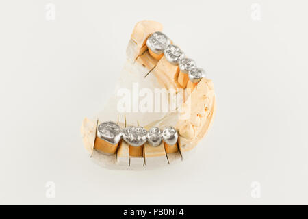 bases of metal-cast bridges on an artificial dental model Stock Photo