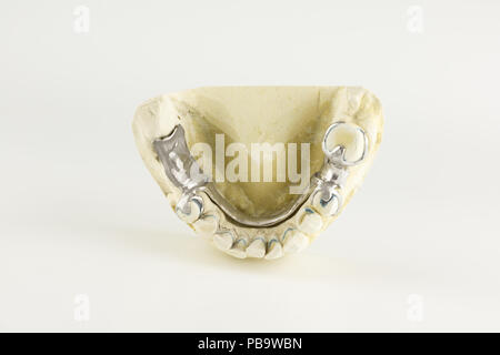 steel base of the clasp prosthesis on the gypsum model Stock Photo