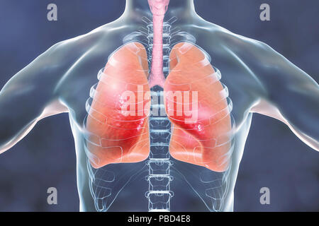 Human lungs, computer illustration. Stock Photo