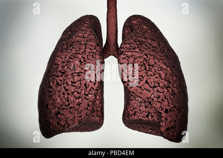 Smoker's lungs, illustration Stock Photo - Alamy