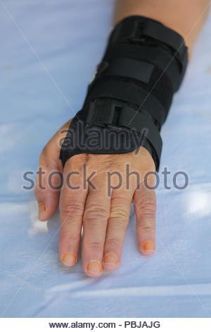 A wrist support on the arm of a person who has just had a plate inserted for broken wrist bones Stock Photo