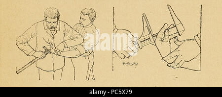 13 Bertillon - Identification anthropométrique (1893) 019 Stock Photo