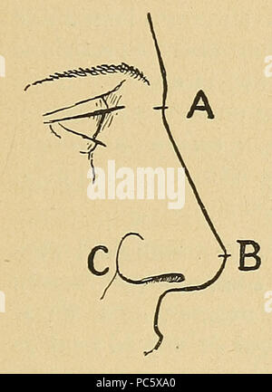 13 Bertillon - Identification anthropométrique (1893) 155 Stock Photo