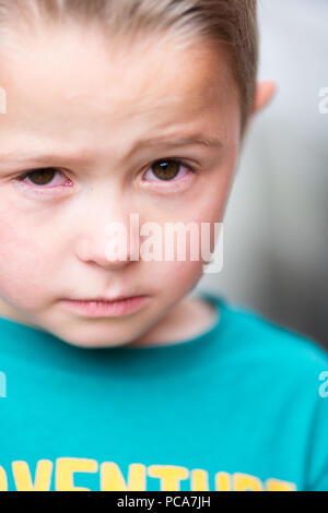 Closeup of teary eyed little boy Stock Photo