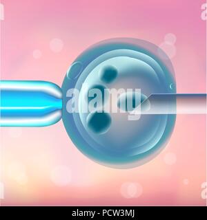 Egg selection in in vitro fertilization (IVF), illustration. Removing oocytes from the ovary of a woman. Stock Photo