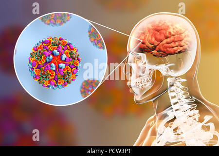 Western equine encephalitis viruses infecting human brain, computer illustration. This is an RNA (ribonucleic acid) virus from the Alphavirus genus. It is an arbovirus (arthropod-borne virus) and is transmitted to humans, birds and horses by mosquito bite. Symptoms in humans range from mild flu-like symptoms to inflammation of the brain, coma, and death. Stock Photo