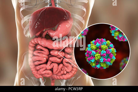 Norovirus infection, computer illustration. Norovirus is a genus of RNA (ribonucleic acid) viruses (of the family Caliciviridae), which cause about half of all gastroenteritis cases around the world. The disease is characterised by nausea, vomiting, diarrhoea and abdominal pain. The diarrhoea results in fluid loss and dehydration, which may become life-threatening in the young, the elderly, and the immunocompromised if not treated promptly. Stock Photo