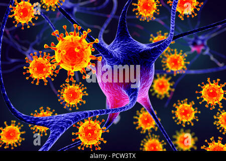 Viral encephalitis. Conceptual illustration showing viruses infecting neurons. Stock Photo