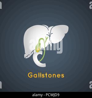 Gallstone vector logo icon illustration Stock Vector