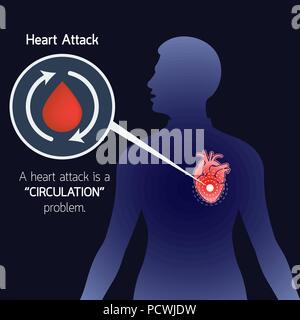 Heart Attack vector logo icon illustration Stock Vector