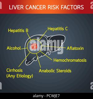 liver cancer risk factors vector logo icon illustration Stock Vector
