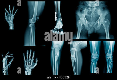 collection x-ray in blue tone Stock Photo