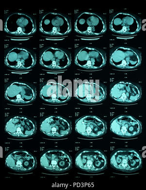 Sequence of horizontal sections of a female human brain, MRI scans, magnetic resonance imaging, Stock Photo