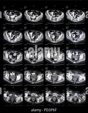 Sequence of horizontal sections of a female human brain, MRI scans, magnetic resonance imaging, Stock Photo