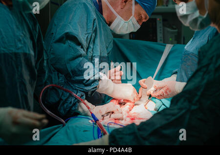 Concentrated doctor, assistant and nurse in a patient during a hysterectomy operation in a hospital Stock Photo