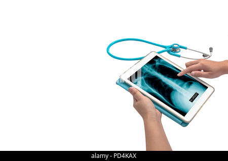hand touching tablet with x-ray image Stock Photo