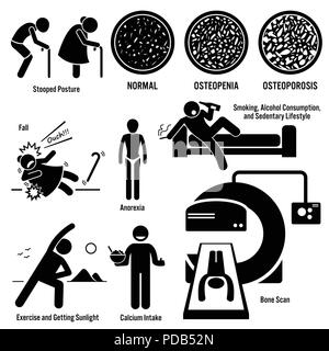 Osteoporosis Old Man Woman Symptoms Risk Factors Prevention Diagnosis Stick Figure Pictogram Icons Stock Vector